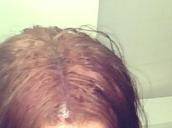 damaged-hair-before-henna-hair-dye