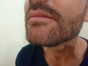 After-using-chemical-free-blond-beard-dye